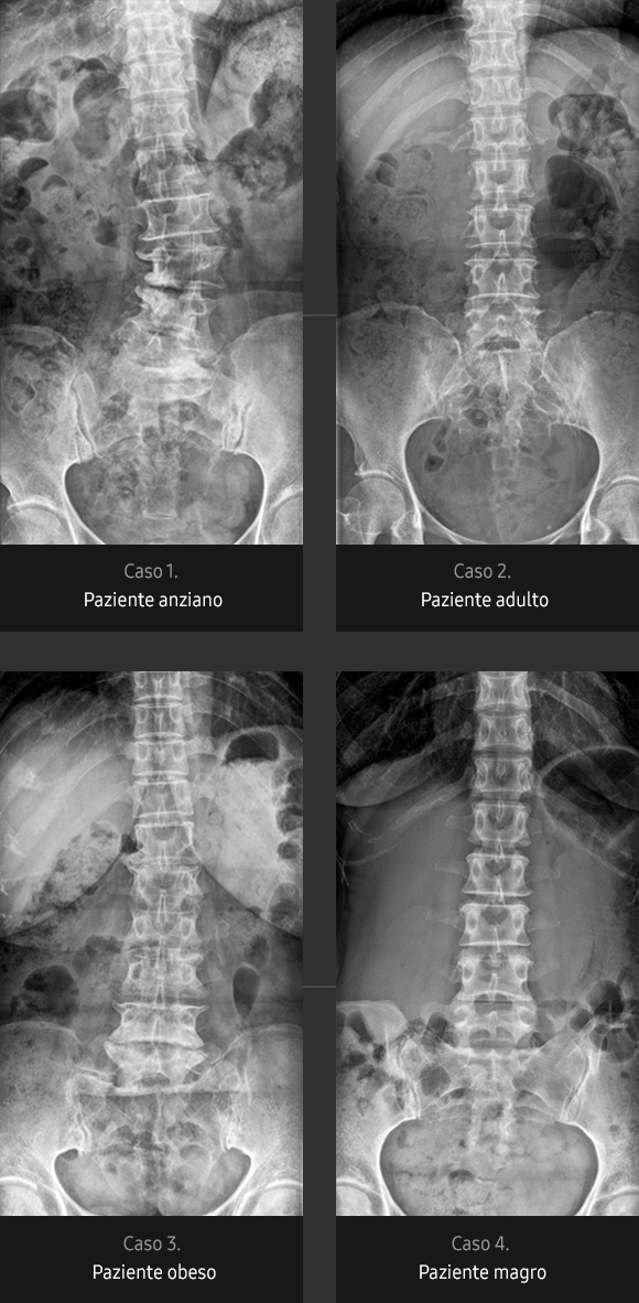 Immagini radiografiche in diverse condizioni di esame