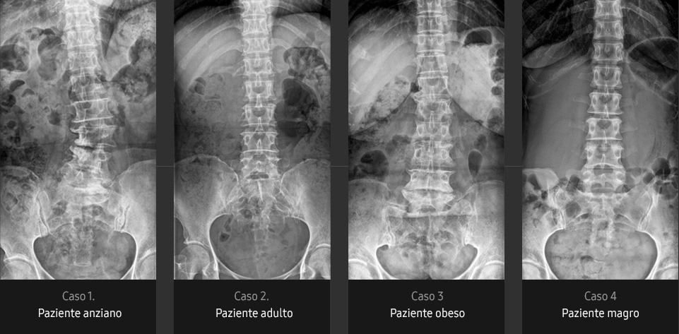 Immagini radiografiche in diverse condizioni di esame