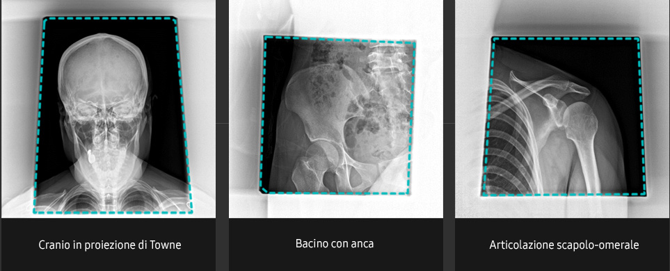 Immagini radiografiche in diverse condizioni di esame