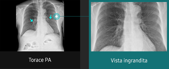 Immagini radiografiche in diverse condizioni di esame con elevata definizione e chiarezza