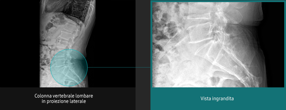 Immagini radiografiche in diverse condizioni di esame con elevata definizione e chiarezza