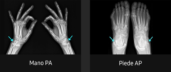 Immagini radiografiche in diverse condizioni di esame con elevata definizione e chiarezza