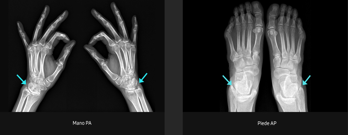 Immagini radiografiche in diverse condizioni di esame con elevata definizione e chiarezza