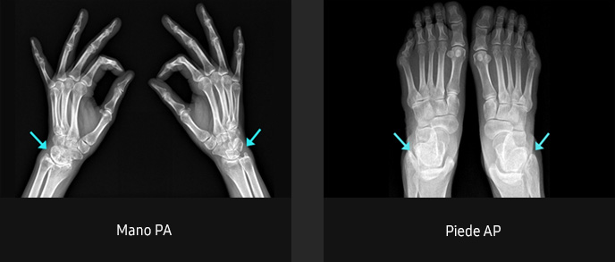 Immagini radiografiche in diverse condizioni di esame con elevata definizione e chiarezza
