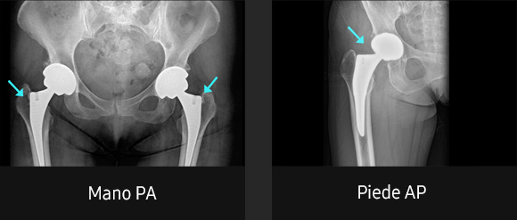 Immagini radiografiche in diverse condizioni di esame con elevata definizione e chiarezza