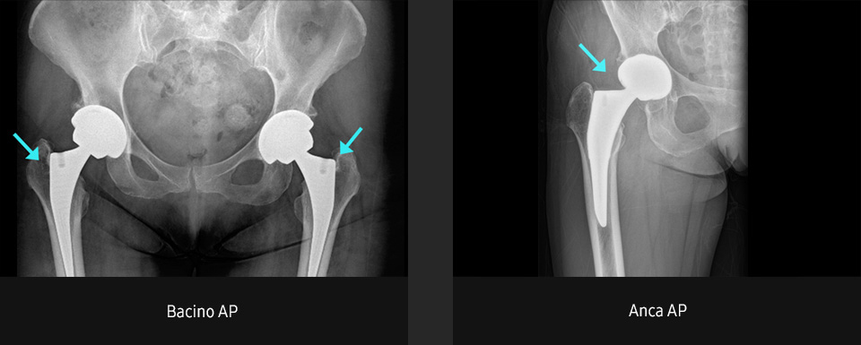 Immagini radiografiche in diverse condizioni di esame con elevata definizione e chiarezza