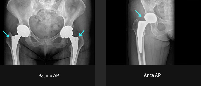 Immagini radiografiche in diverse condizioni di esame con elevata definizione e chiarezza
