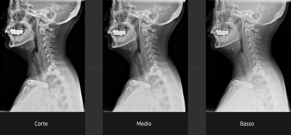 Immagini radiografiche in diverse condizioni di esame con elevata definizione e chiarezza