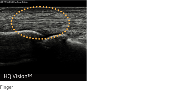 HQ Vision™ Finger