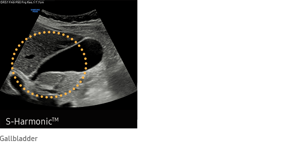 S-Harmonic™ Gallbladder