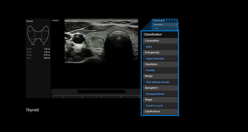 S-Detect™ for Thyroid™