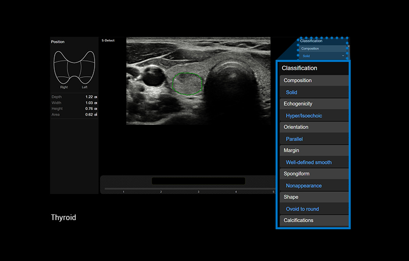 S-Detect™ for Thyroid™