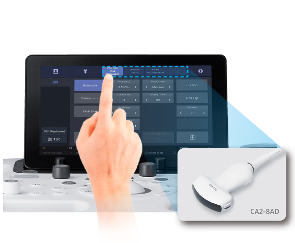 Finger zeigt auf Touchscreen von Ultraschallsystem HS40 und Convex-Sonde ist rechts vergrößert dargestellt.