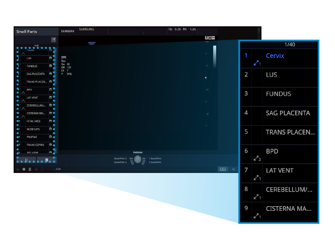 EZ-Exam Ausschnitt von Ultraschallsystem HS40.