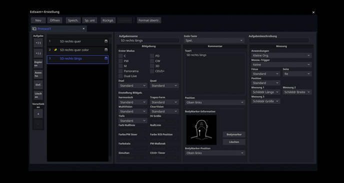 S-Vue transducer  Sample