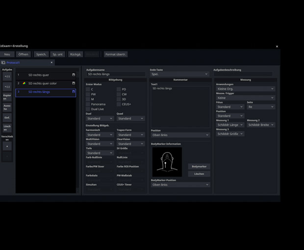 S-Vue transducer  Sample