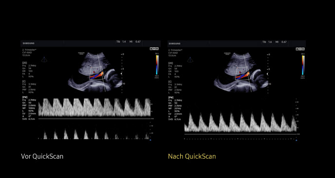 S-Vue transducer  Sample