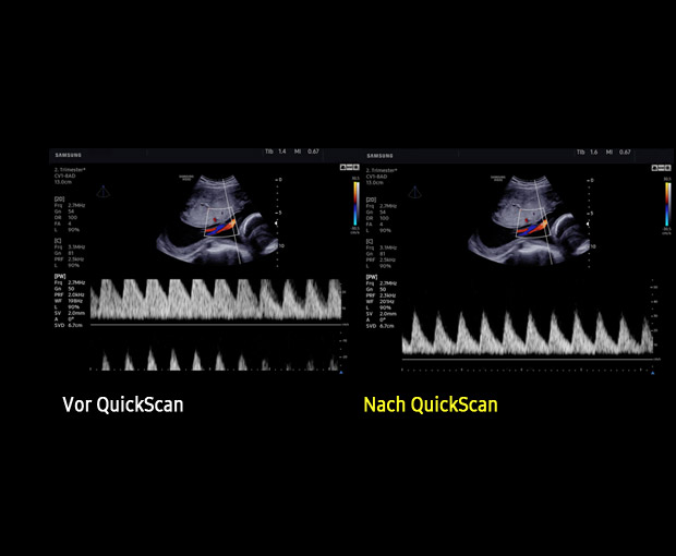 S-Vue transducer  Sample