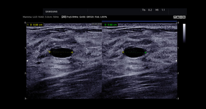 S-Vue transducer  Sample