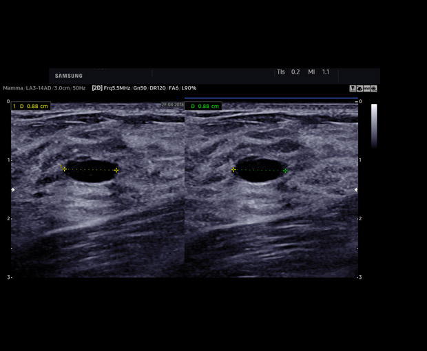 S-Vue transducer  Sample