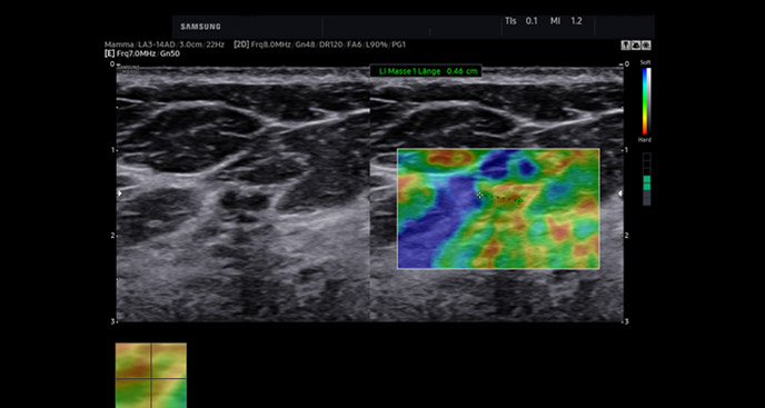 S-Vue transducer  Sample