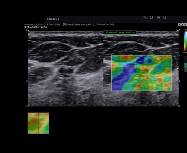 S-Vue transducer  Sample
